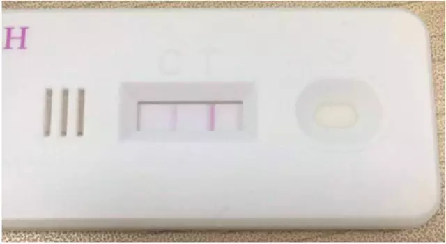 每日大赛在线91，每日大赛在线观看网页版 但在顶级赛事版权储备上