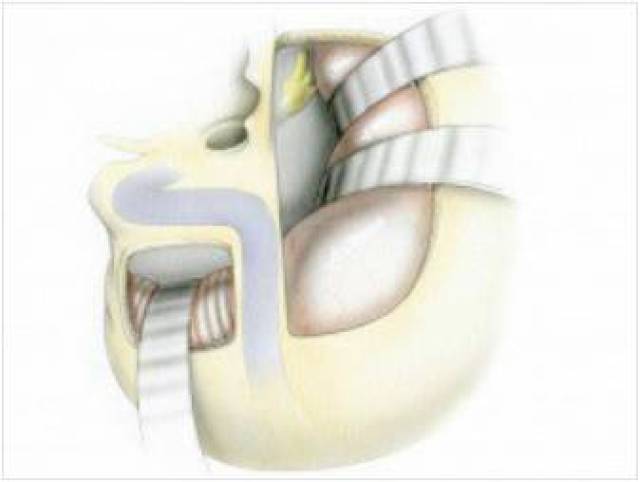高速上白实线变道会被拍吗 最合法的上白实线选择
