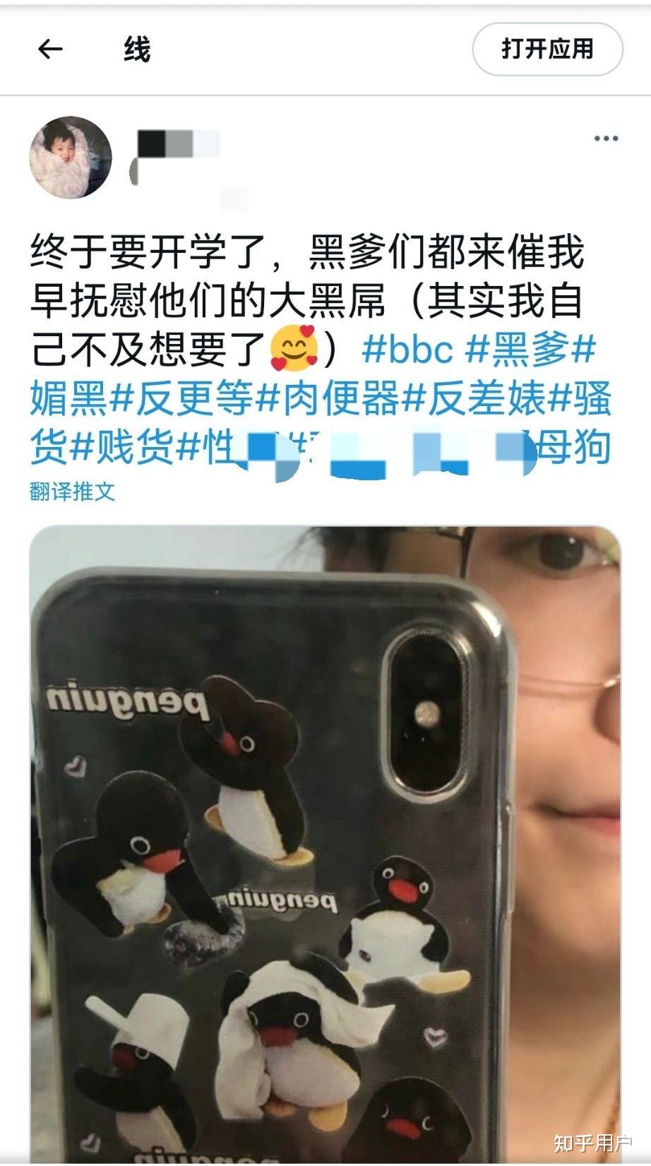 妹妹勾引哥哥 或在家庭中极度缺乏爱与关注